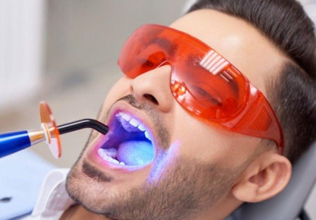 Teeth Whitening